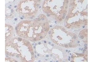 Immunohistochemistry (IHC) image for anti-Coactosin-Like Protein (AA 1-142) antibody (ABIN7436669)