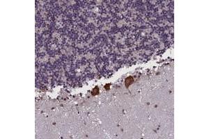 Immunohistochemical staining of human cerebellum with KCNE1L polyclonal antibody  shows strong cytoplasmic positivity in purkinje cells. (KCNE1-Like 抗体)