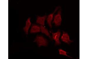 ABIN6267259 staining SK-OV3 by IF/ICC. (EGFR 抗体  (pThr693))