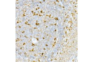 Immunohistochemistry (IHC) image for anti-Transmembrane Protein 173 (TMEM173) (AA 170-379) antibody (ABIN1683049)