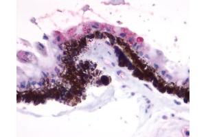 Anti-RGR antibody IHC of human eye, pigmented epithelium within the retina. (RGR 抗体  (Extracellular Domain))