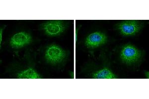 ICC/IF Image LARS2 antibody [N2C1], Internal detects LARS2 protein at mitochondria by immunofluorescent analysis. (LARS2 抗体)