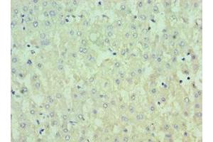 Immunohistochemistry of paraffin-embedded human liver tissue using ABIN7156797 at dilution of 1:100 (IL13RA2 抗体  (AA 27-343))