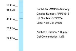 Western Blotting (WB) image for anti-Matrix Metallopeptidase 25 (MMP25) (Middle Region) antibody (ABIN2789901) (MMP25 抗体  (Middle Region))