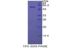 SDS-PAGE analysis of Rat MX1 Protein. (MX1 蛋白)