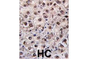 Immunohistochemistry (IHC) image for anti-Phosphatidylethanolamine N-Methyltransferase (PEMT) antibody (ABIN2995586) (PEMT 抗体)