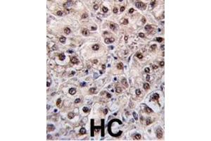 Immunohistochemistry (IHC) image for anti-Phosphatidylethanolamine N-Methyltransferase (PEMT) antibody (ABIN2995586)