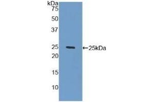 Detection of Recombinant GLb, Human using Polyclonal Antibody to Galactosidase Beta (GLb) (GLB1 抗体  (AA 68-219))