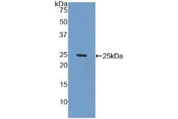 GLB1 antibody  (AA 68-219)