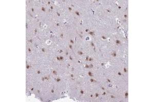 Immunohistochemical staining of human cerebral cortex with NOVA2 polyclonal antibody  shows moderate nuclear positivity in neuronal cells at 1:20-1:50 dilution. (NOVA2 抗体)