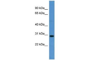 WB Suggested Anti-SPRED2  Antibody Titration: 0. (SPRED2 抗体  (C-Term))