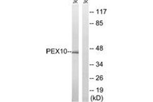 Western blot analysis of extracts from Jurkat cells, using PEX10 Antibody. (PEX10 抗体  (AA 183-232))