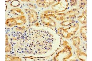 Immunohistochemistry of paraffin-embedded human kidney tissue using ABIN7144235 at dilution of 1:100 (ANKRD55 抗体  (AA 151-326))