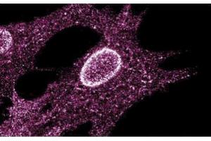 Immunofluorescent staining on Human Fibroblasts (LYN 抗体  (AA 1-138))