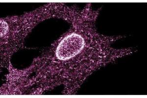 Immunofluorescent staining on Human Fibroblasts (LYN 抗体  (AA 1-138))