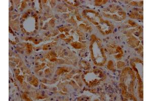 IHC image of ABIN7147846 diluted at 1:200 and staining in paraffin-embedded human kidney tissue performed on a Leica BondTM system. (Clathrin Heavy Chain (CLTC) (AA 851-990) 抗体)