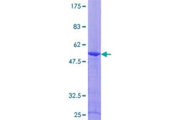 ARL4D Protein (AA 1-201) (GST tag)