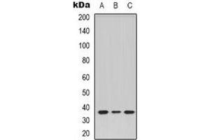 Western blot analysis of TRB1 expression in Hela (A), COLO205 (B), L929 (C) whole cell lysates. (TAS2R14 抗体)