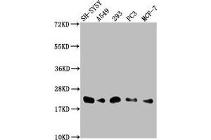 Western Blot Positive WB detected in: SH-SY5Y whole cell lysate, A549 whole cell lysate, 293 whole cell lysate, PC-3 whole cell lysate, MCF-7 whole cell lysate All lanes: ITGB1BP1 antibody at 1:2000 Secondary Goat polyclonal to rabbit IgG at 1/50000 dilution Predicted band size: 22, 17 kDa Observed band size: 22 kDa (ITGB1BP1 抗体  (AA 1-200))