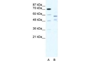 WB Suggested Anti-TRIM23 Antibody Titration:  5. (TRIM23 抗体  (C-Term))