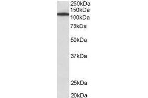 Staining of NIH3T3 lysate using Myosin-Ib antibody at 1 µg/ml (35µg protein in RIPA buffer). (Myosin IB 抗体  (Internal Region))