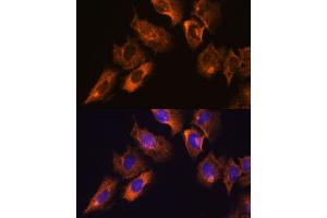 Immunofluorescence analysis of C6 cells using CAMKV antibody (ABIN7266051) at dilution of 1:100. (CAMKV 抗体  (AA 1-285))