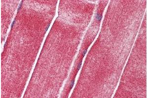 Human Skeletal Muscle: Formalin-Fixed, Paraffin-Embedded (FFPE) (SLC36A2 抗体  (AA 36-85))