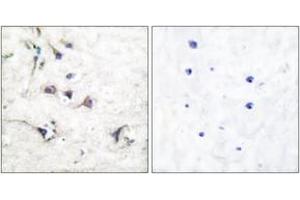 Immunohistochemistry analysis of paraffin-embedded human brain tissue, using Ezrin Antibody. (Ezrin 抗体  (AA 511-560))
