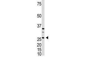 Image no. 1 for anti-Dickkopf Homolog 4 (Xenopus Laevis) (DKK4) (C-Term) antibody (ABIN357074) (DKK4 抗体  (C-Term))
