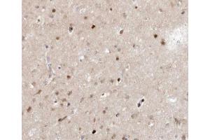 ABIN6266659 at 1/100 staining human brain tissue sections by IHC-P. (SENP7 抗体  (C-Term))