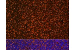 Immunofluorescence (IF) image for anti-Patched 1 (PTCH1) antibody (ABIN7255007)