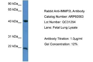 WB Suggested Anti-IMMP2L  Antibody Titration: 0. (IMMP2L 抗体  (C-Term))
