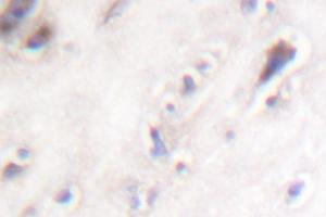 Image no. 2 for anti-Islet Amyloid Polypeptide (IAPP) antibody (ABIN271869) (Amylin/DAP 抗体)