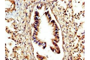 IHC image of ABIN7149978 diluted at 1:300 and staining in paraffin-embedded human lung tissue performed on a Leica BondTM system.