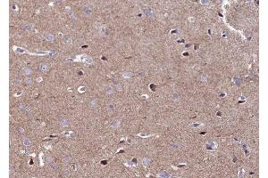ABIN6269408 at 1/100 staining human brain tissue sections by IHC-P. (CaMK2 alpha/delta 抗体)