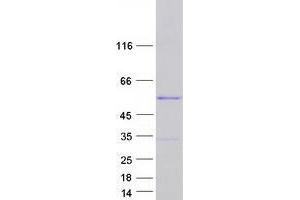 Western Blotting (WB) image for Y Box Binding Protein 1 (YBX1) protein (Myc-DYKDDDDK Tag) (ABIN2735716)