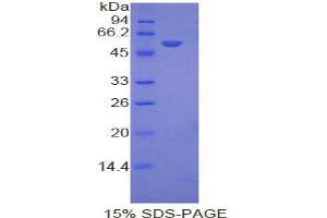 SDS-PAGE analysis of Mouse Ephrin A4 Protein. (EFNA4 蛋白)