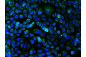 Immunofluorescence (Cultured Cells) (IF (cc)) image for anti-Mast/stem Cell Growth Factor Receptor (KIT) (AA 350-440) antibody (ABIN1387260)