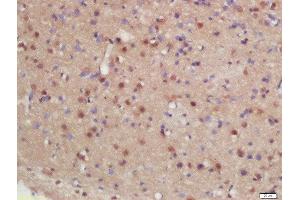 Formalin-fixed and paraffin embedded rat brain labeled with Rabbit Anti-hHR23b Polyclonal Antibody, Unconjugated (ABIN2175752) at 1:200 followed by conjugation to the secondary antibody and DAB staining (RAD23B 抗体  (AA 24-120))