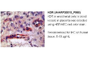 Image no. 1 for anti-VEGF Receptor 2 (VEGFR2) (N-Term) antibody (ABIN2792307) (VEGFR2/CD309 抗体  (N-Term))