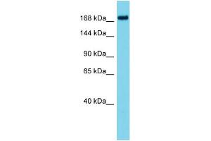 ATAD2B 抗体  (N-Term)