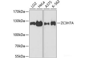 Western Blotting (WB) image for anti-Zinc Finger CCCH-Type Containing 7A (ZC3H7A) antibody (ABIN7256700)