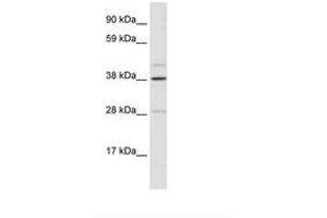 Image no. 1 for anti-Ceramide Synthase 3 (CERS3) (AA 54-103) antibody (ABIN6735903)