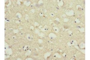 Immunohistochemistry of paraffin-embedded human brain tissue using ABIN7161221 at dilution of 1:100 (Neurexin 3 抗体  (AA 1584-1643))