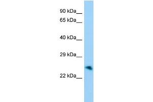 Host:  Rabbit  Target Name:  Unkl  Sample Type:  Mouse Stomach lysates  Antibody Dilution:  1. (UNKL 抗体  (Middle Region))