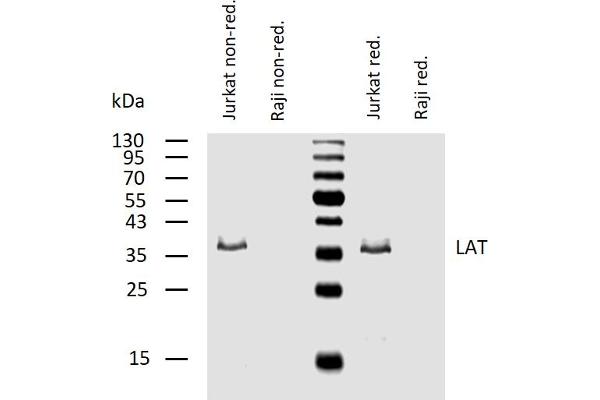 LAT 抗体  (Cytoplasmic Domain)
