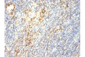 Formalin-fixed, paraffin-embedded human Tonsil stained with Transglutaminase II Mouse Monoclonal Antibody (SPM358).