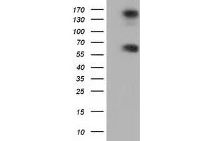 Western Blotting (WB) image for anti-Butyrophilin, Subfamily 1, Member A1 (BTN1A1) antibody (ABIN1496993) (BTN1A1 抗体)