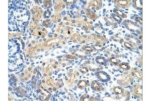 Image no. 1 for anti-U11/U12 SnRNP 35 KDa Protein (AA 29-78) antibody (ABIN203037) (SNRNP35 抗体  (AA 29-78))
