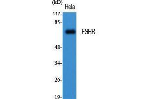 Western Blot (WB) analysis of specific cells using FSHR Polyclonal Antibody. (FSHR 抗体  (Internal Region))